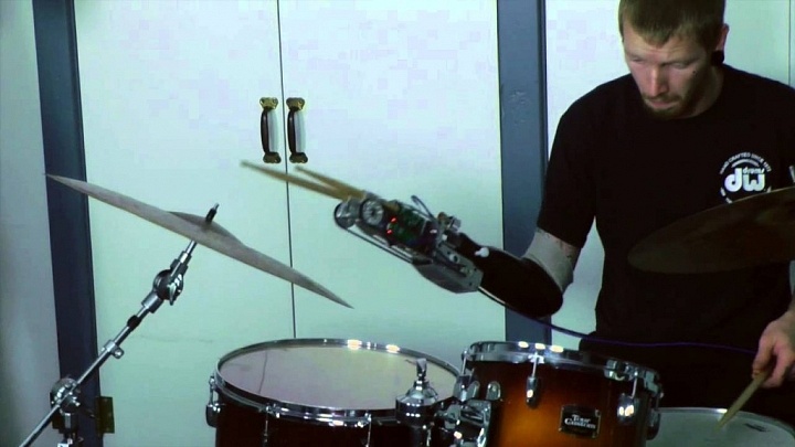 Cyborg Drummer Gets His Beat Back On Tour Monthly
